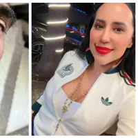 “Hoy elijo mi salud”: Sandra Cuevas muestra su recuperación en VIDEOS tras entrar al quirófano