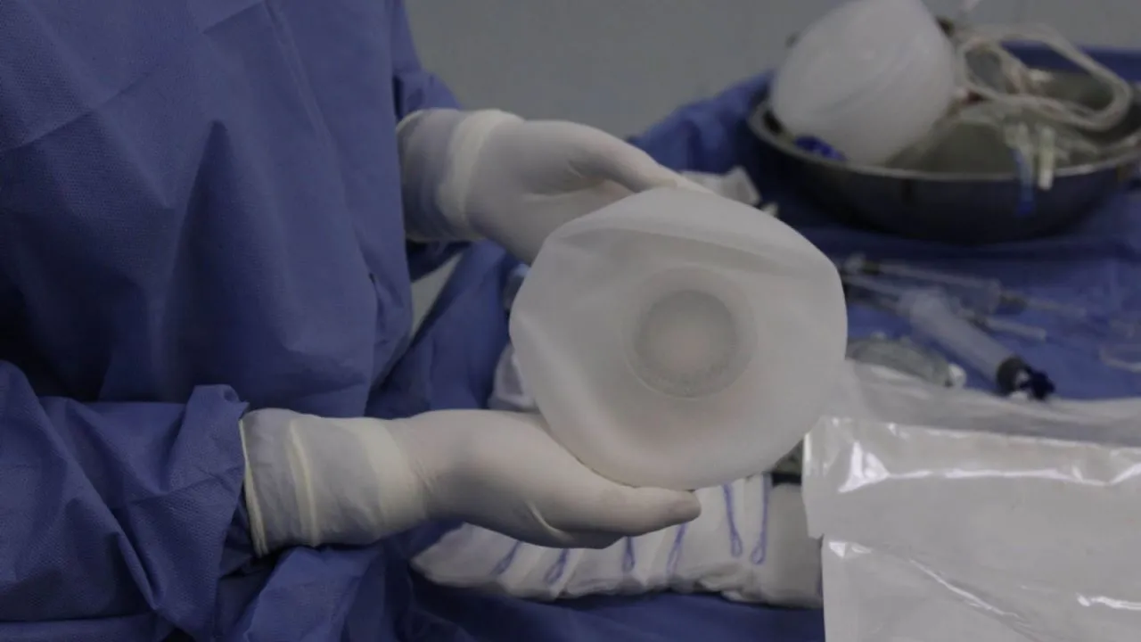 El libro “El cuerpo perfecto”, de Ana Lilia Pérez, destapa los riesgos de las cirugías estéticas