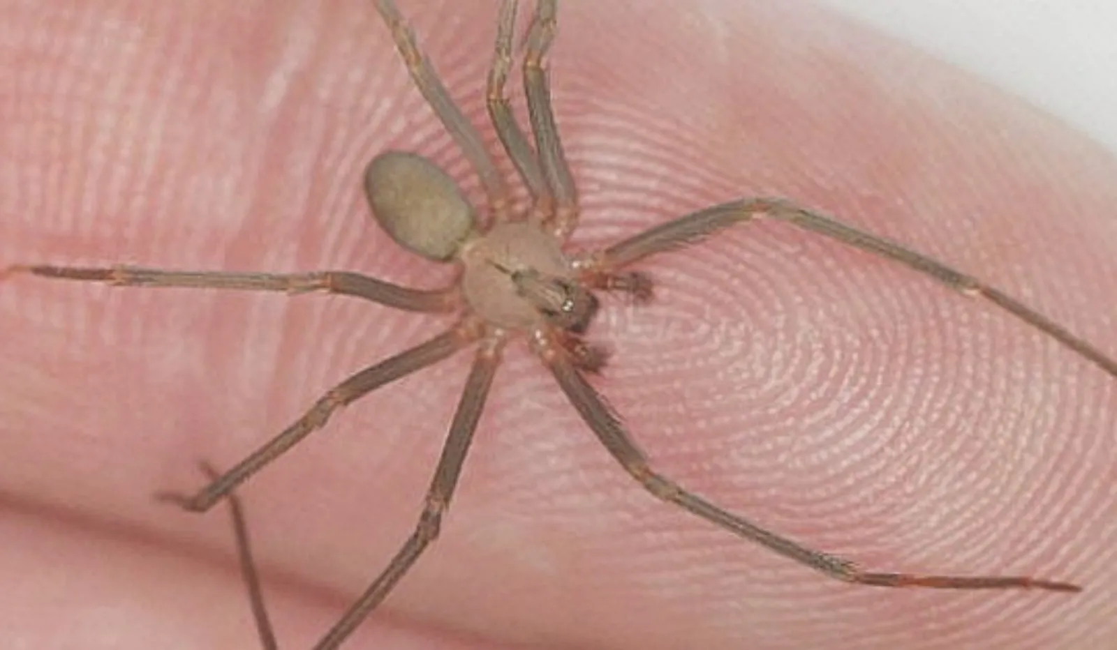 Lo muerde araña violinista y le niegan atención médica en Puebla