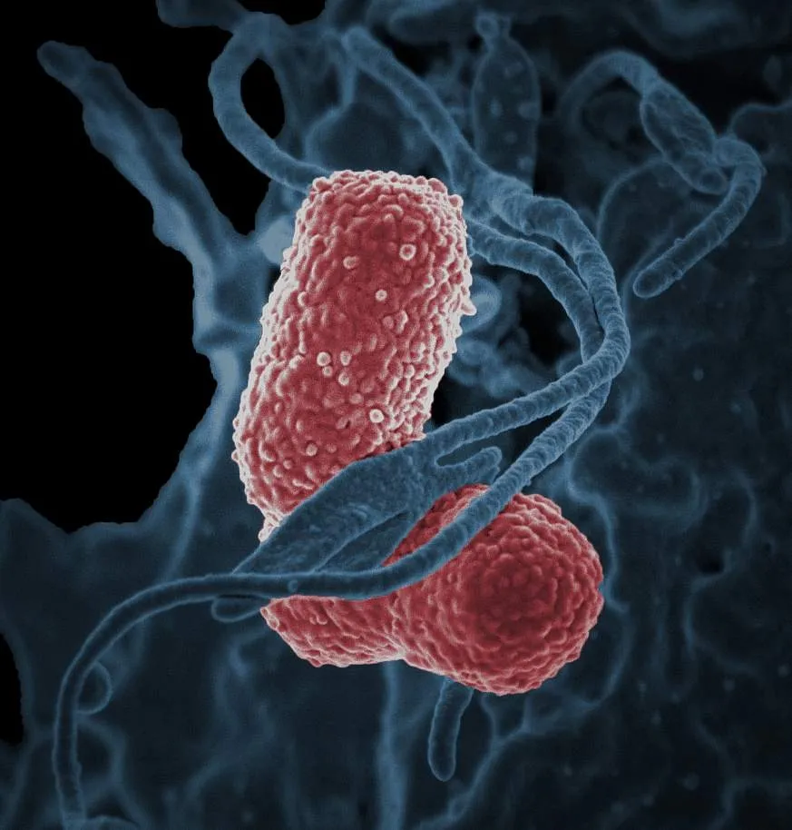 Trece niños mueren por brote de la bacteria Klebsiella oxytoca en Edomex
