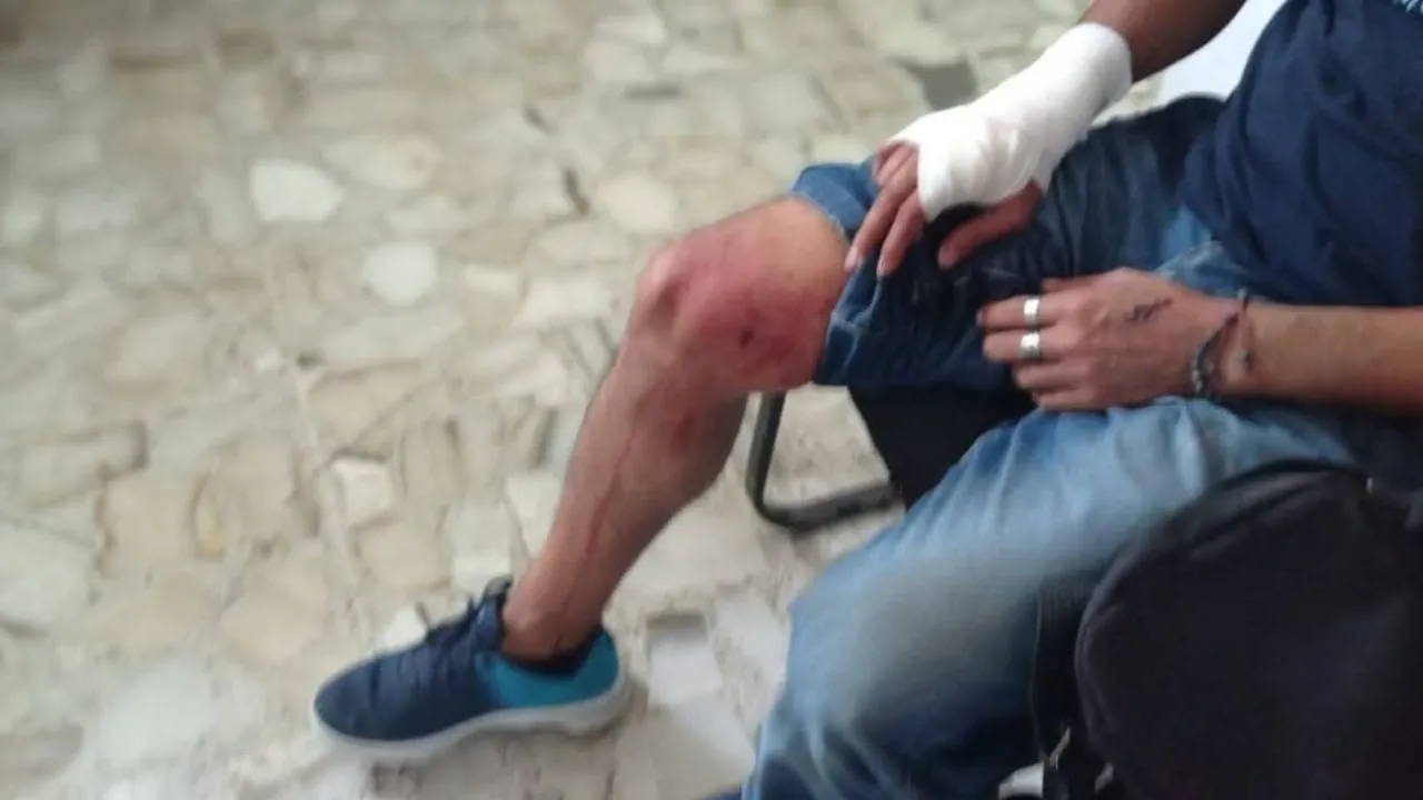 Francisco Magaña, reportero de Guerrero, sufre intento de homicidio con un arma blanca